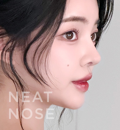 휜코교정