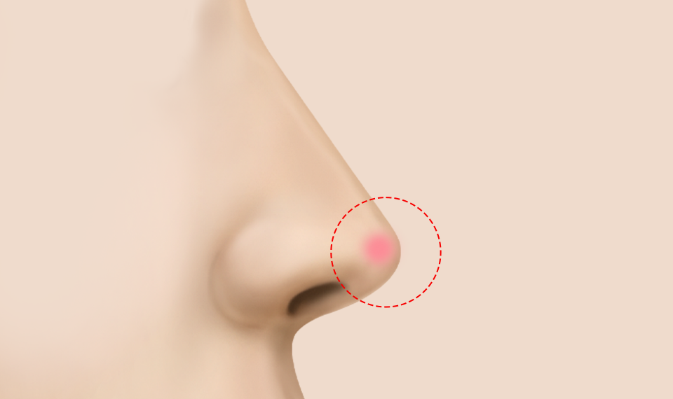 붓거나 염증이 생겨 압통, 지끈거림 등의 통증이 반복되는 경우